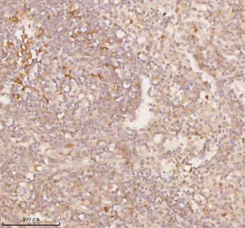 Anti-SSSCA1/ZNRD2 Antibody