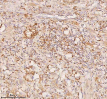 Anti-SSSCA1/ZNRD2 Antibody