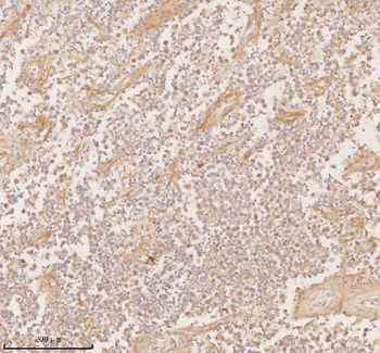 Anti-SSSCA1/ZNRD2 Antibody