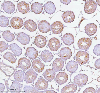 Anti-SOAT1 Antibody