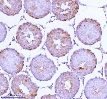 Anti-SOAT1 Antibody