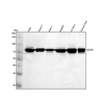 Anti-SOAT1 Antibody