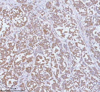 Anti-SOAT1 Antibody