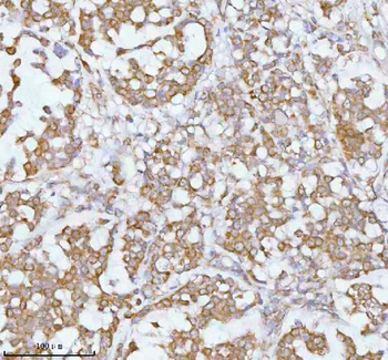 Anti-SOAT1 Antibody
