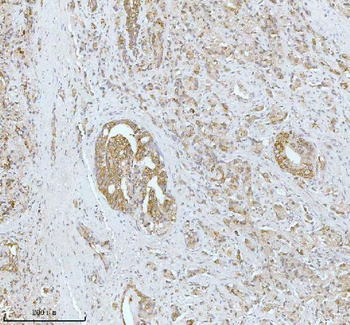 Anti-SOAT1 Antibody