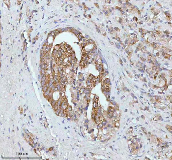 Anti-SOAT1 Antibody