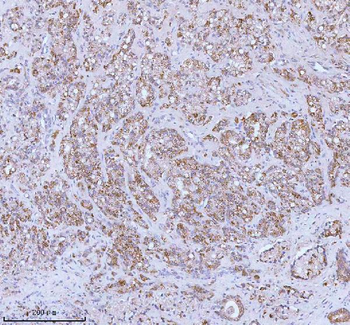 Anti-SOAT1 Antibody