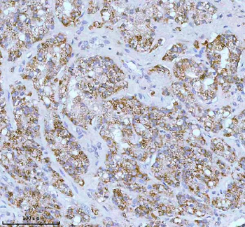 Anti-SOAT1 Antibody