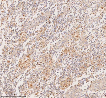 Anti-DDX58/RIG-1 Antibody