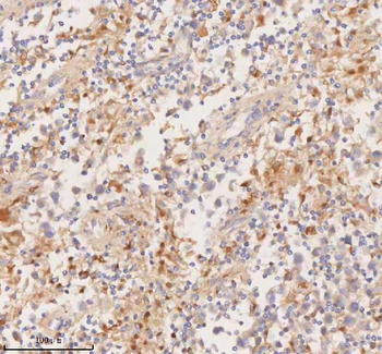 Anti-DDX58/RIG-1 Antibody