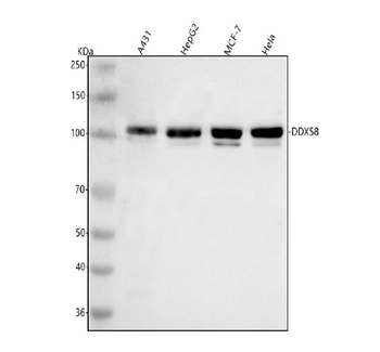 Anti-DDX58/RIG-1 Antibody