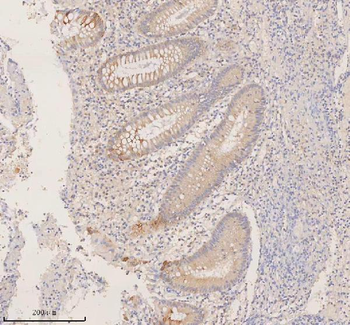 Anti-DDX58/RIG-1 Antibody