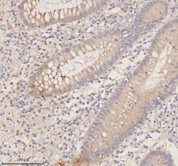 Anti-DDX58/RIG-1 Antibody
