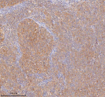 Anti-DDX58/RIG-1 Antibody