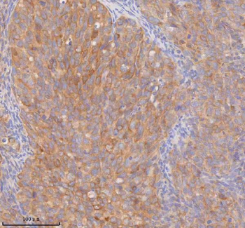 Anti-DDX58/RIG-1 Antibody