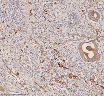 Anti-DDX58/RIG-1 Antibody