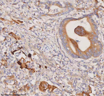 Anti-DDX58/RIG-1 Antibody