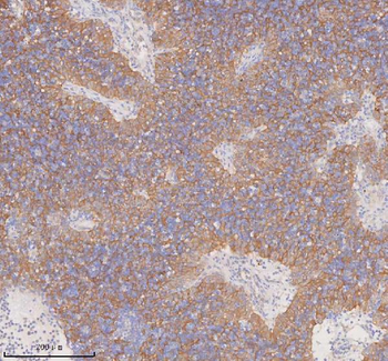 Anti-DDX58/RIG-1 Antibody