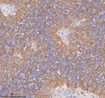 Anti-DDX58/RIG-1 Antibody