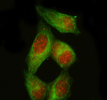 Anti-PDX1 Antibody