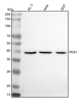 Anti-PDX1 Antibody