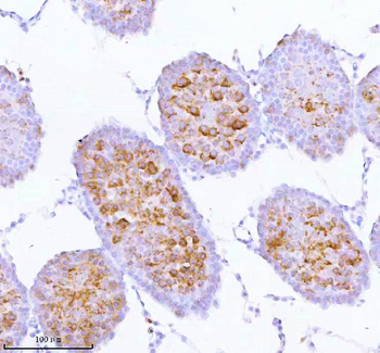 Anti-SPA17 Antibody