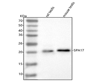 Anti-SPA17 Antibody
