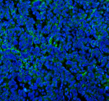 Anti-SPA17 Antibody