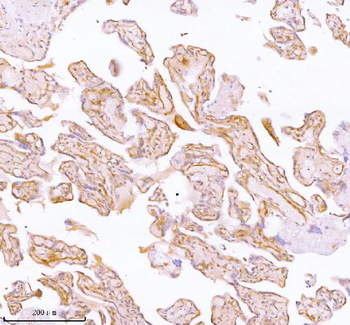 Anti-SPA17 Antibody