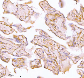 Anti-SPA17 Antibody