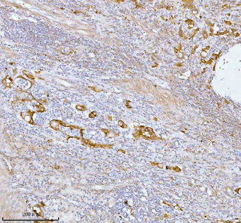 Anti-SPA17 Antibody