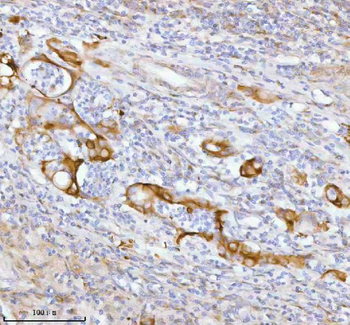 Anti-SPA17 Antibody