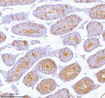 Anti-SPA17 Antibody