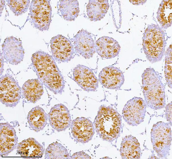 Anti-SPA17 Antibody