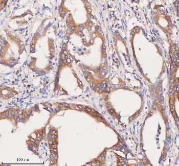 Anti-SCAMP3 Antibody