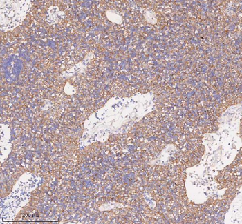 Anti-SCAMP3 Antibody