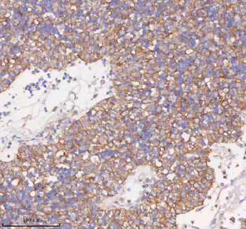 Anti-SCAMP3 Antibody