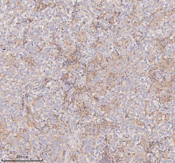 Anti-SCAMP3 Antibody