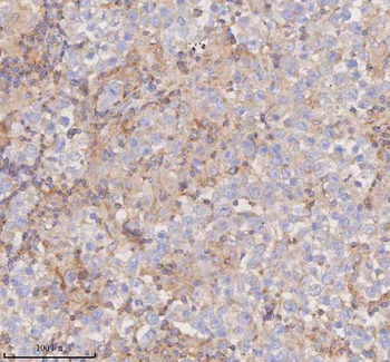 Anti-SCAMP3 Antibody