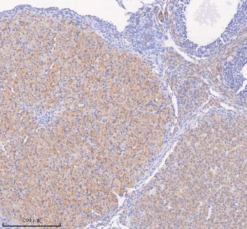 Anti-SCAMP3 Antibody