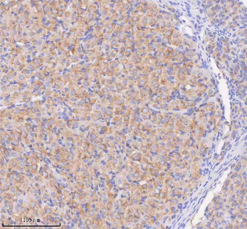 Anti-SCAMP3 Antibody