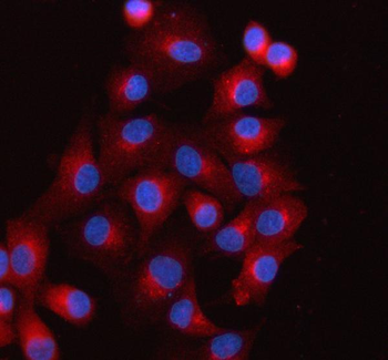 Anti-SCAMP3 Antibody