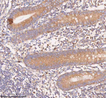 Anti-SCAMP3 Antibody