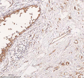 Anti-SCAMP3 Antibody