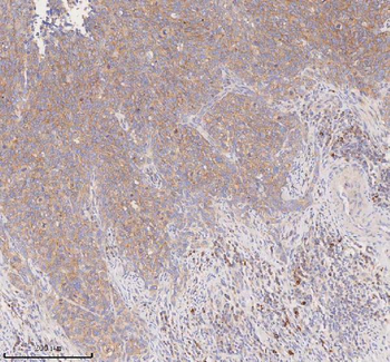Anti-SCAMP3 Antibody