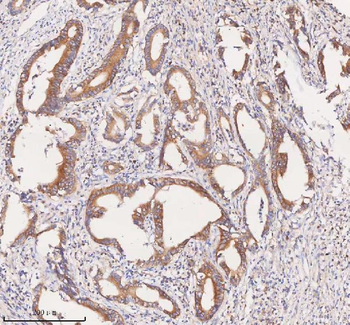 Anti-SCAMP3 Antibody