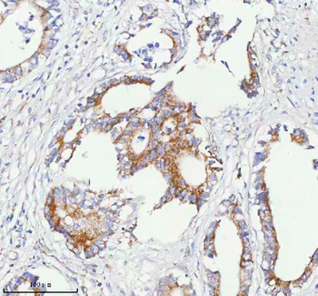 Anti-SASS6 Antibody