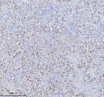 Anti-SASS6 Antibody