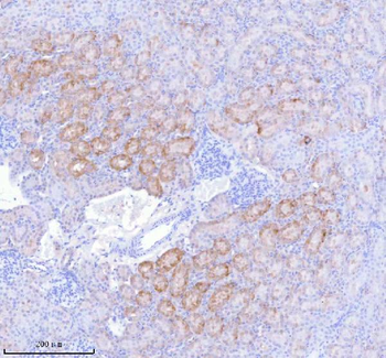 Anti-SASS6 Antibody