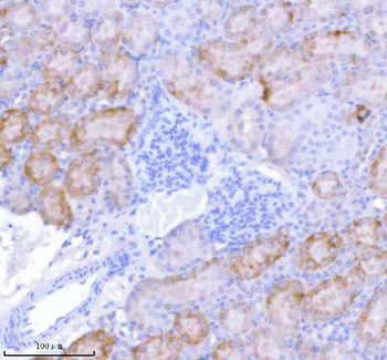 Anti-SASS6 Antibody